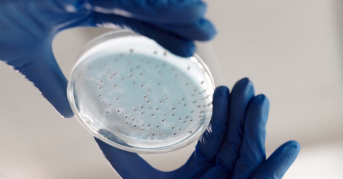 Close-up of hands in gloves holding a petri dish for microbiology analysis in a lab.