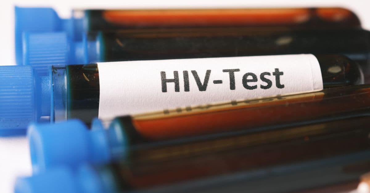 A detailed close-up image showing blood samples labeled for HIV testing.
