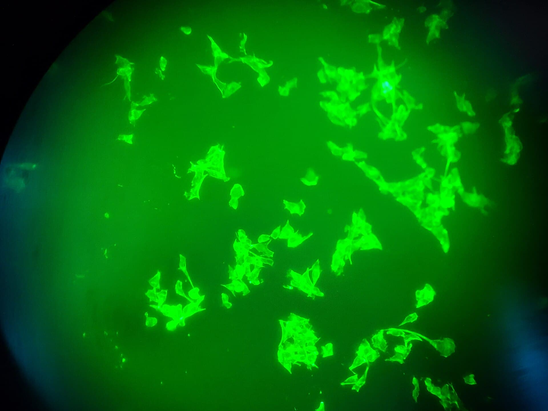 Fluorescence microscopy image of oral cancer cells used to visualize biological structures.