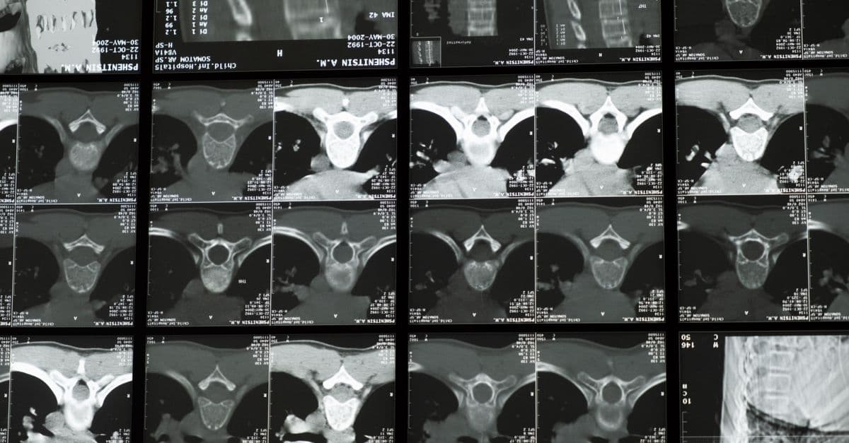 High-resolution radiological images showcasing the complex structure of the human spine for medical examination.