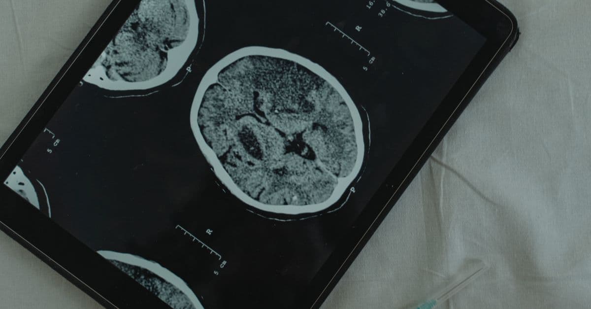 Close-up view of a brain CT scan displayed on a digital tablet with a medical needle beside it.