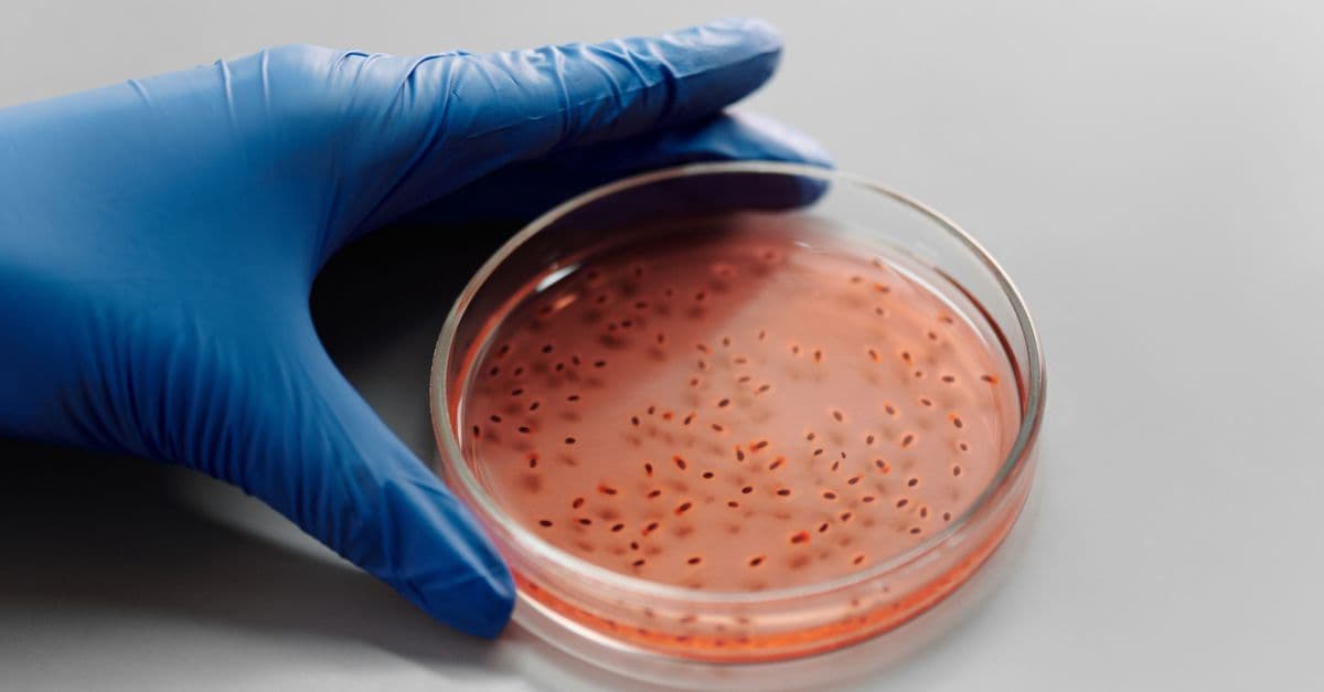 Close-up of a gloved hand holding a bacteria culture in a petri dish for laboratory analysis.