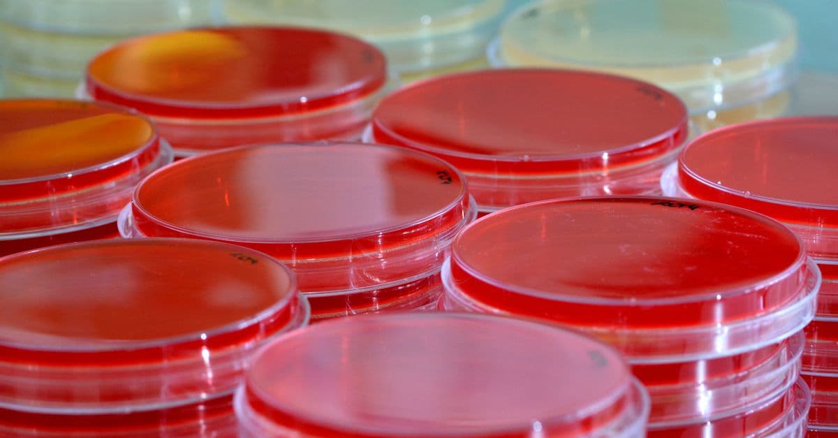 From above of transparent glass Petri dishes with blood samples for testing in modern  laboratory laboratory