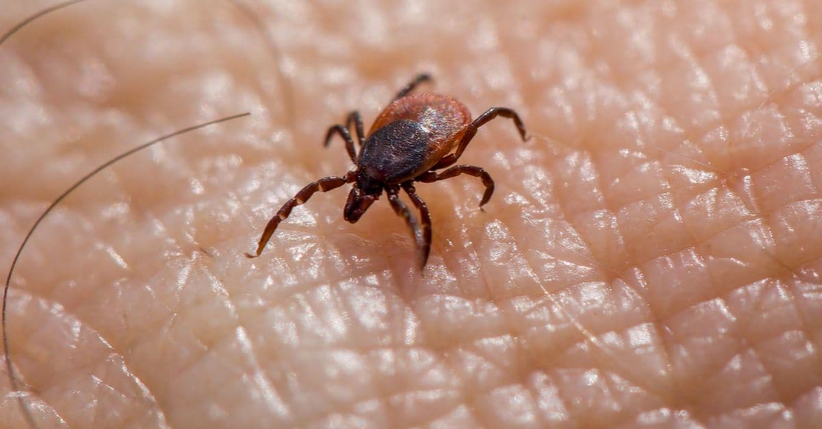 Macro image of a tick on human skin, highlighting the risk of Lyme disease.