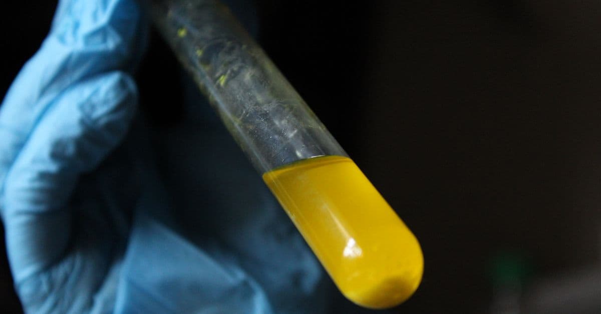 A gloved hand holds a test tube filled with yellow liquid, symbolizing scientific research.