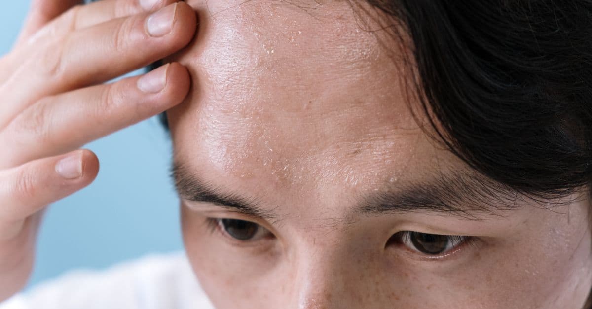 Close-up of a man with sweat on his forehead, touching it with his hand, conveying stress or illness.