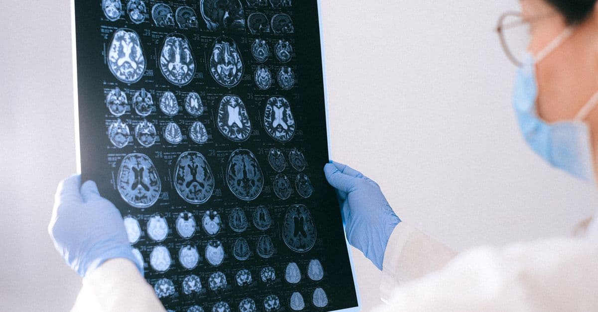 A medical professional reviewing MRI brain scans in a clinical setting, highlighting healthcare technology.