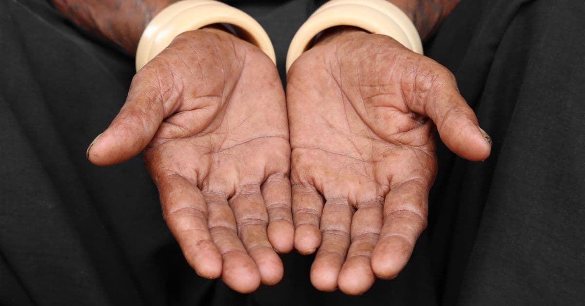 Detailed close-up of open hands of an elderly person, emphasizing texture and bangle adornments.