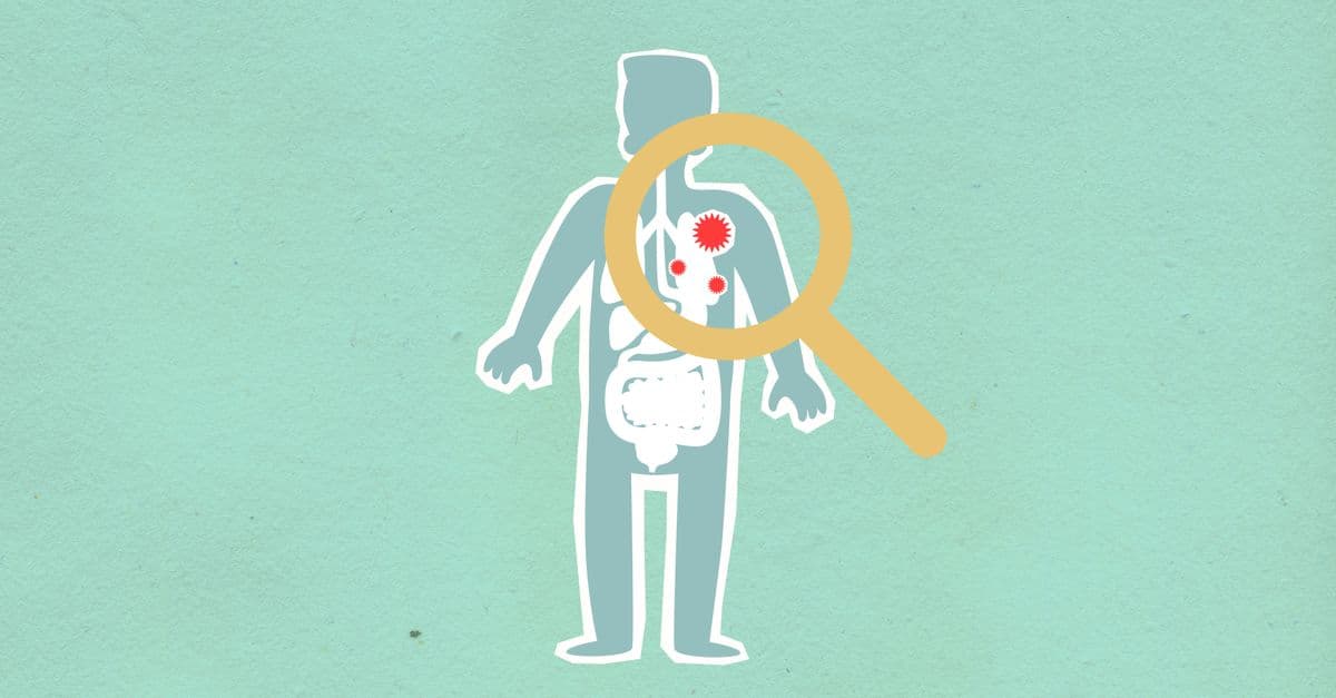 Paper cutout of man under magnifying glass with red viruses spreading on internal organs on green background during disease propagation