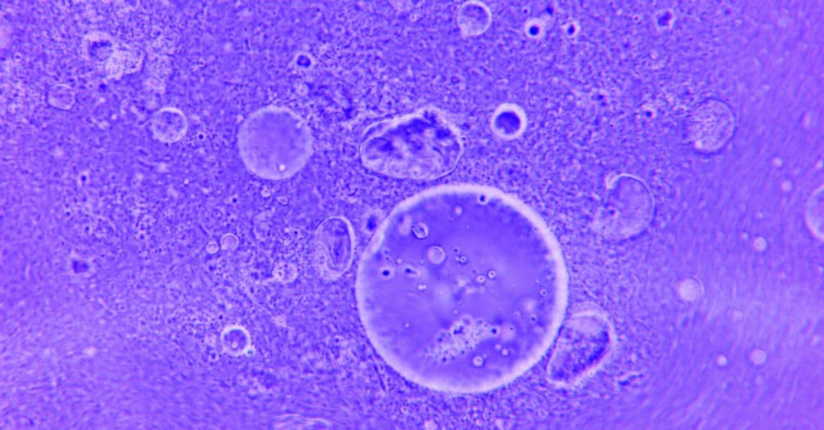 Blue abstract image of water droplets and particles under a microscope.