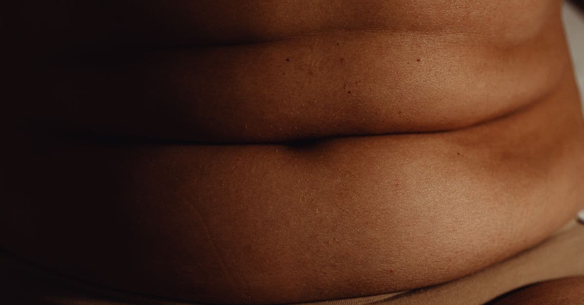 Detailed close-up of human skin highlighting natural texture and folds.