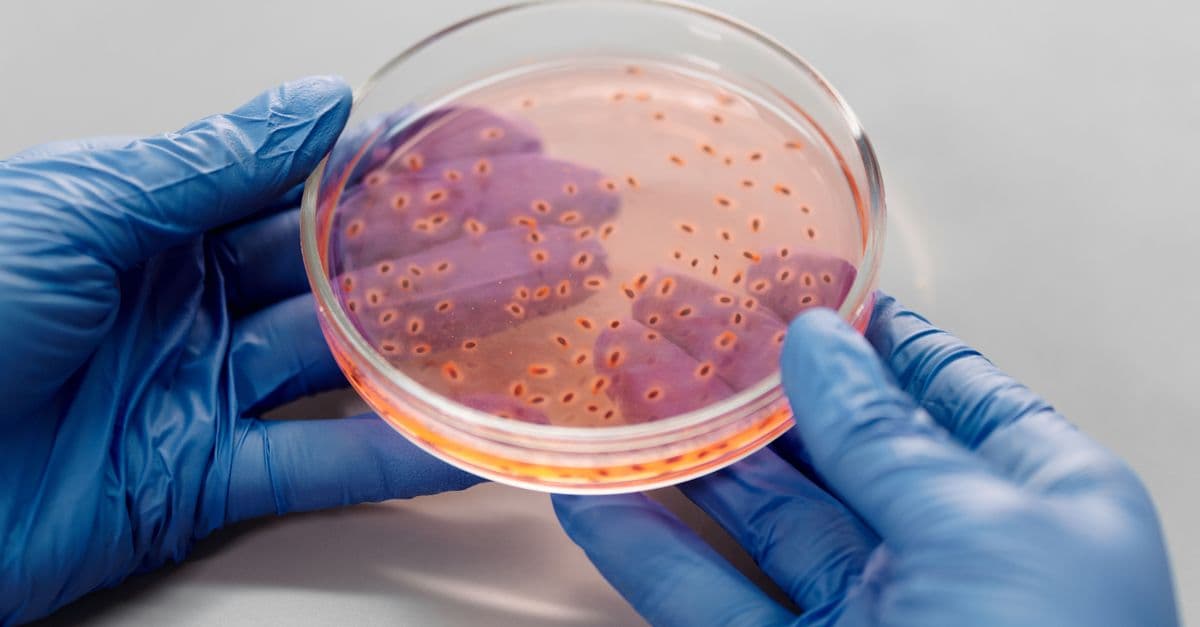 Close-up of gloved hands holding a petri dish with bacterial culture in a lab setting.