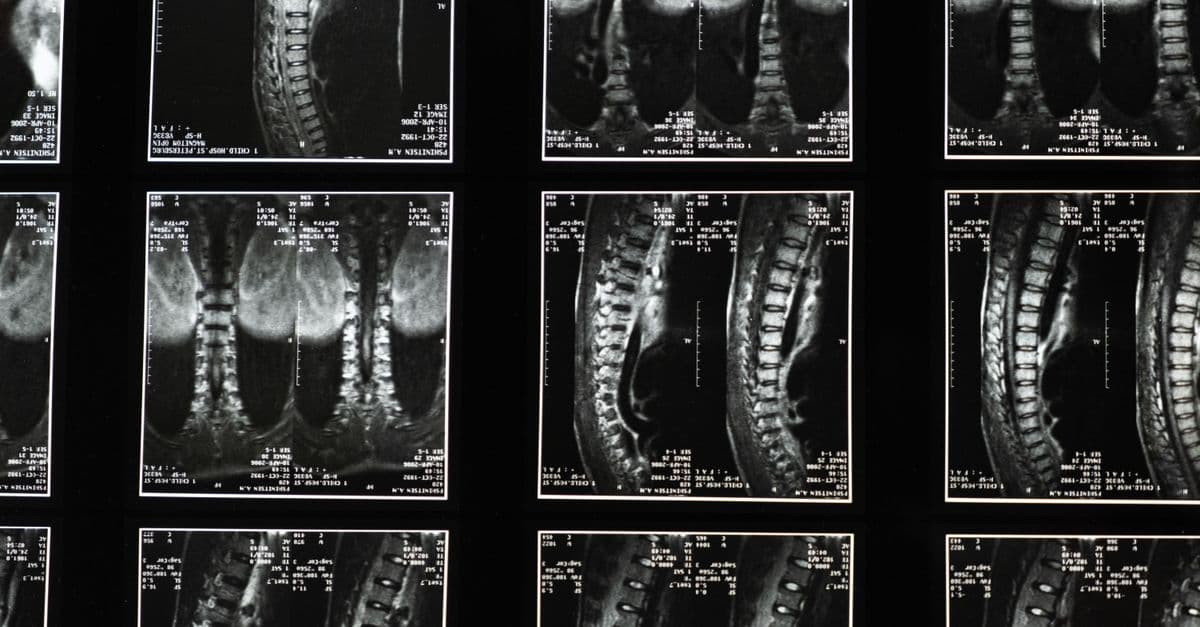 Comprehensive spinal x-ray images, ideal for medical studies and diagnostics.