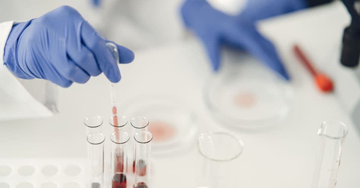 A scientist using pipette for chemical analysis in a laboratory with test tubes and protective gloves.