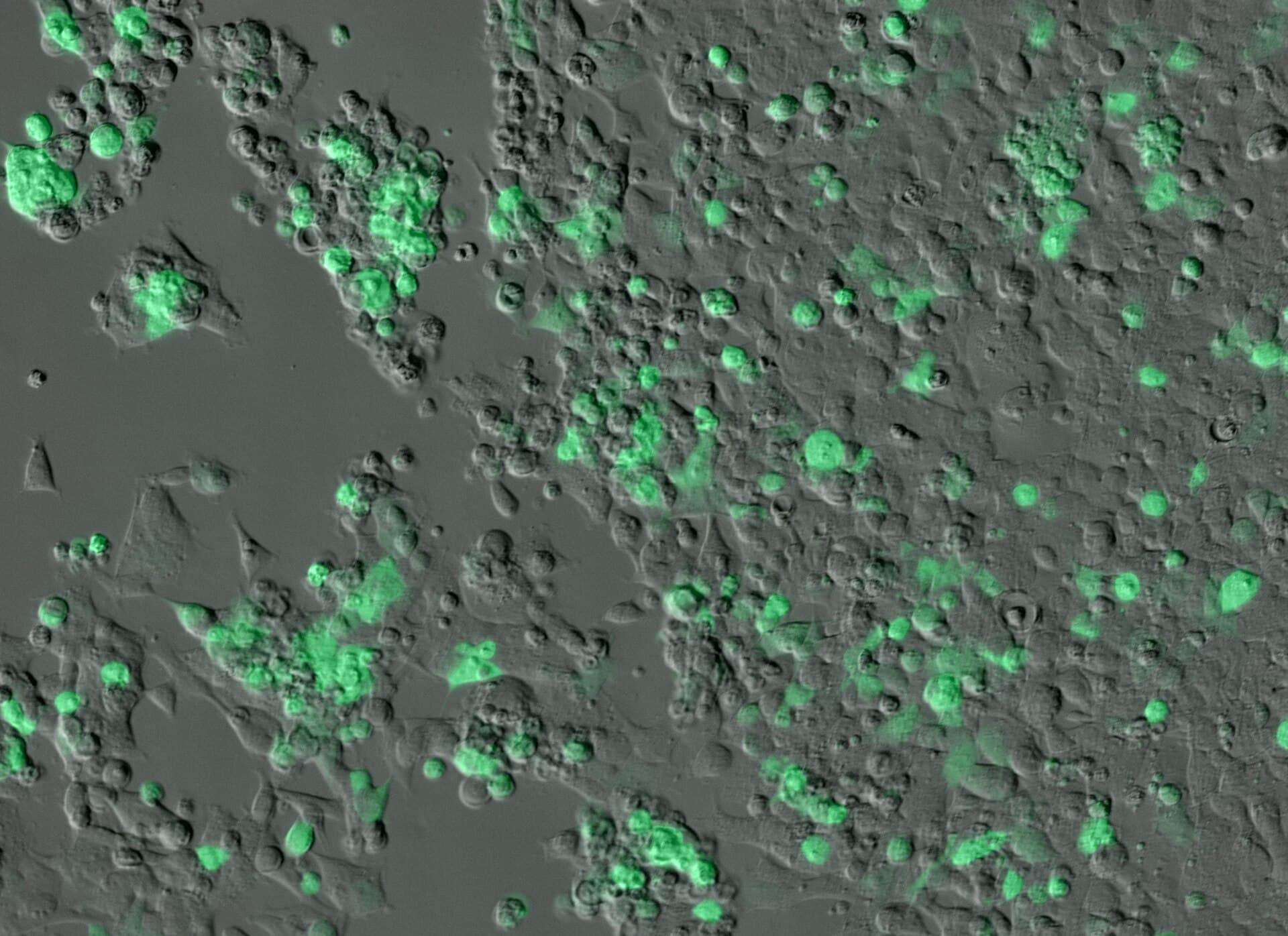 Fluorescence microscopy image of human embryonic kidney cells used to visualize individual-cell biology.