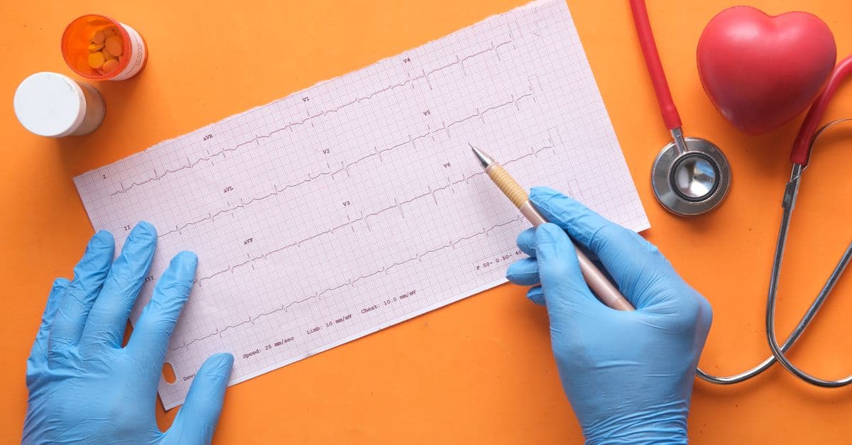 Hands with gloves analyzing an electrocardiogram on an orange background with stethoscope and pills.