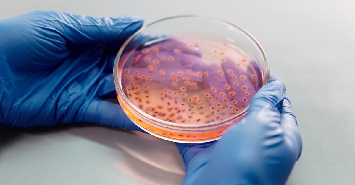 Scientist's hands with gloves examining bacterial culture in a petri dish for laboratory research.
