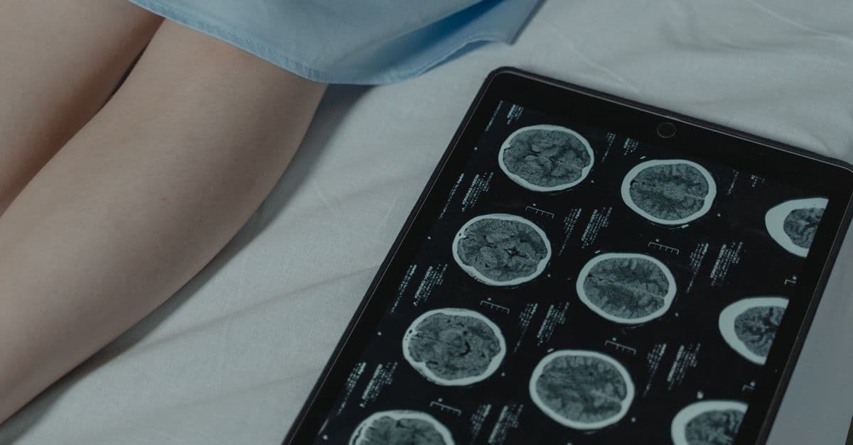 Close-up of brain CT scan display on tablet beside patient's legs in a hospital room.