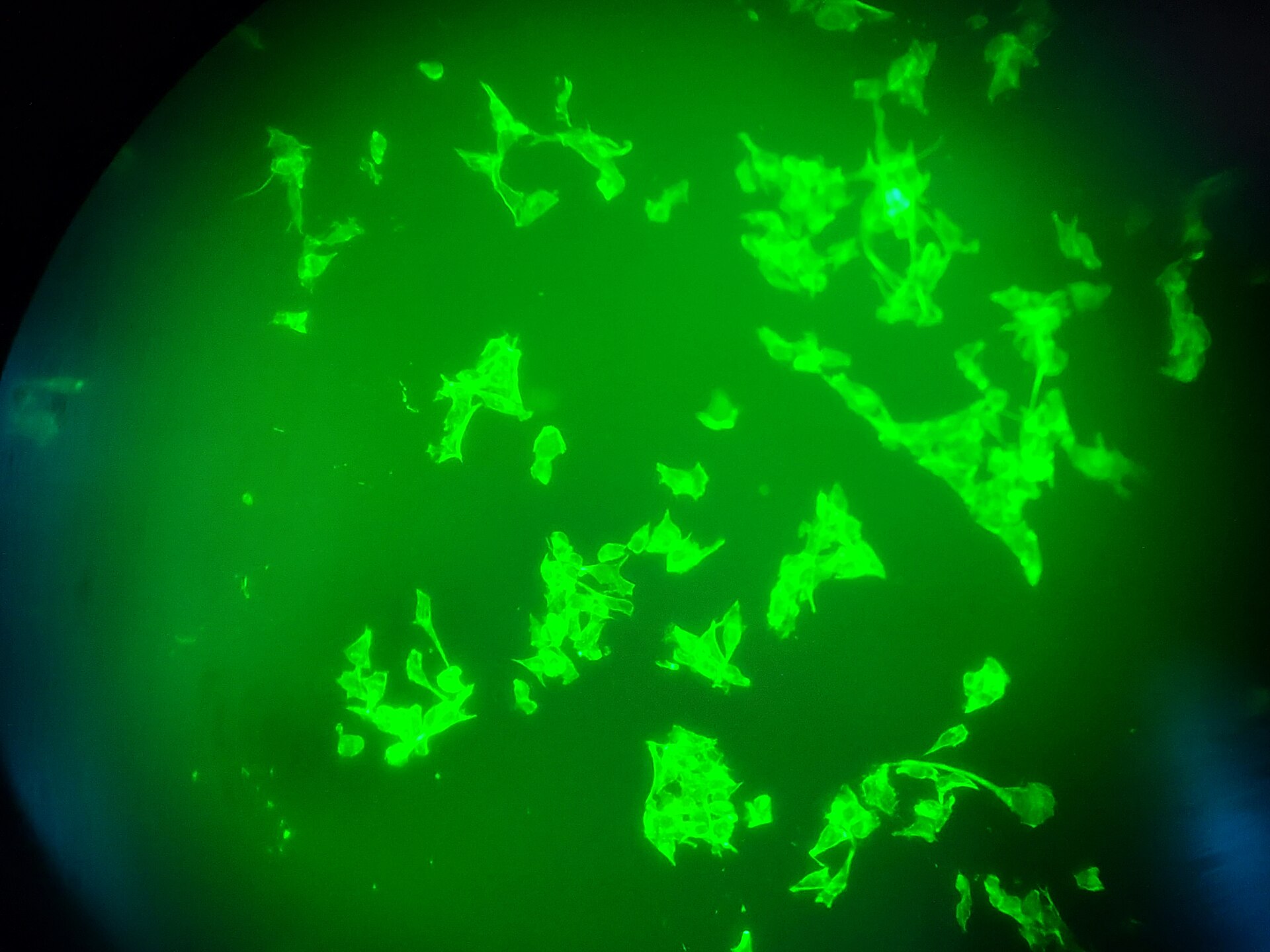 Fluorescence microscopy image of oral cancer cells used to visualize biological structures.